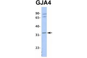 Host:  Rabbit  Target Name:  GJA4  Sample Type:  721_B  Antibody Dilution:  1. (GJA4 Antikörper  (Middle Region))