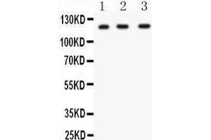 Anti- HIF 1 alpha Picoband antibody, Western blotting All lanes: Anti HIF 1 alpha  at 0.
