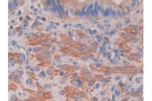 Immunohistochemistry (IHC) image for anti-Pyruvate Dehydrogenase Kinase, Isozyme 4 (PDK4) (AA 117-387) antibody (ABIN7439630)