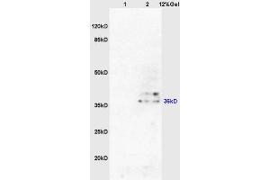 SDS-PAGE (SDS) image for anti-Aldo-Keto Reductase Family 1, Member A1 (Aldehyde Reductase) (AKR1A1) (AA 53-130) antibody (ABIN872733)
