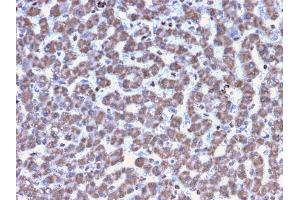 Immunohistochemistry (IHC) image for anti-Prohibitin (PHB) (AA 167-261) antibody (ABIN6940306)