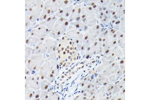 Immunohistochemistry of paraffin-embedded mouse pancreas using KPN Rabbit pAb (ABIN6131812, ABIN6142991, ABIN6142992 and ABIN6224371) at dilution of 1:100 (40x lens). (KPNA3 Antikörper  (AA 1-210))