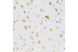 Immunohistochemistry of paraffin-embedded mouse brain using SYK Antibody (ABIN5971150) at dilution of 1/100 (40x lens). (SYK Antikörper)