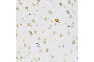 Immunohistochemistry of paraffin-embedded mouse brain using SYK Antibody (ABIN5971150) at dilution of 1/100 (40x lens).