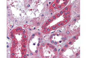 Immunohistochemistry (IHC) image for anti-Albumin (ALB) (Middle Region) antibody (ABIN2776970) (Albumin Antikörper  (Middle Region))