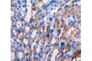 IHC-P analysis of Kidney tissue, with DAB staining. (IL-15 Antikörper  (AA 49-162))