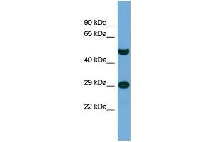 Host:  Rabbit  Target Name:  NPAS3  Sample Type:  THP-1 Whole Cell lysates  Antibody Dilution:  1.