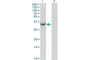 Western Blot analysis of AKR1C2 expression in transfected 293T cell line by AKR1C2 monoclonal antibody (M03), clone 3C11. (AKR1C2 Antikörper  (AA 224-323))