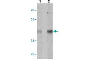 Western blot analysis of MTERFD1 in NIH/3T3 cell lysate with MTERFD1 polyclonal antibody  at (lane 1) 1 and (lane 2) 2 ug/mL.
