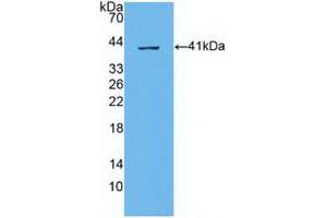 Western blot analysis of recombinant Human ABCA4. (ABCA4 Antikörper  (AA 1398-1727))