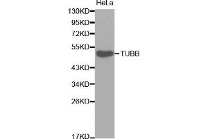 Western blot analysis of extracts of HeLa cells, using TUBB antibody (ABIN5974698). (TUBB1 Antikörper)