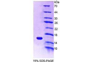 SDS-PAGE analysis of Mouse MIA1 Protein. (MIA Protein)