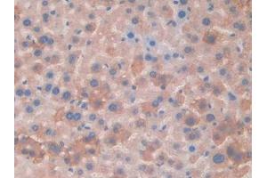 Immunohistochemistry (IHC) image for anti-Monoamine Oxidase A (MAOA) (AA 229-428) antibody (ABIN7438517)