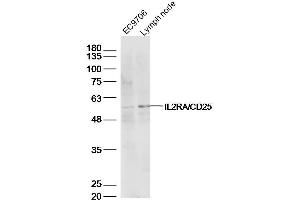Lane 1: EC9706 lysates Lane 2: mouse lymph node lysates probed with IL2RA Polyclonal Antibody, Unconjugated  at 1:500 dilution and 4˚C overnight incubation. (CD25 Antikörper  (AA 201-268))