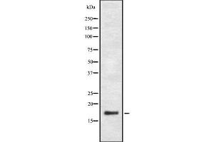 Western Blotting (WB) image for anti-Prostaglandin E Synthase (PTGES) (Internal Region) antibody (ABIN6264163)