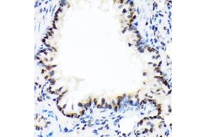 Immunohistochemistry of paraffin-embedded rat lung using DEK Rabbit mAb (ABIN7266724) at dilution of 1:100 (40x lens). (DEK Antikörper)