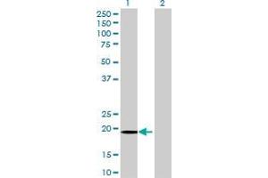 Western Blotting (WB) image for FUNDC2 293T Cell Transient Overexpression Lysate(Denatured) (ABIN1337585)