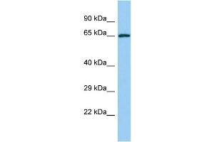 Host: Rabbit Target Name: YTHDF2 Sample Type: Jurkat Whole Cell lysates Antibody Dilution: 1. (YTHDF2 Antikörper  (C-Term))