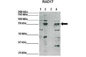 WB Suggested Anti-RAD17 Antibody    Positive Control:  Lane1: 25ug HeLa lysate, Lane2: 25ug Xenopus laevis egg extract, Lane3: 25ug mouse embryonic stem cell lysate, Lane4: 25ug HEK293T lysate   Primary Antibody Dilution :   1:500  Secondary Antibody :   Anti-rabbit-HRP   Secondry Antibody Dilution :   1:3000  Submitted by:  Domenico Maiorano, Institute of Human Genetics, CNRS