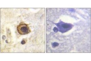 Immunohistochemistry analysis of paraffin-embedded human brain tissue, using PDGFR beta (Ab-1021) Antibody. (PDGFRB Antikörper  (AA 991-1040))