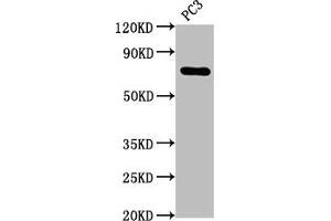 Western Blot Positive WB detected in: PC3 whole cell lysate All lanes: TP63 antibody at 2. (Rekombinanter p63 Antikörper)
