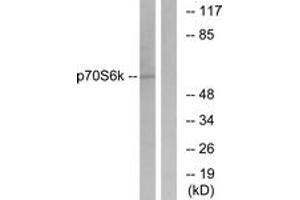 Western blot analysis of extracts from HeLa cells, treated with Insulin 10mU/ml 5', using p70 S6 Kinase (Ab-411) Antibody. (RPS6KB1 Antikörper  (AA 401-450))