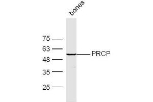 Mouse Bone lysates probed with PRCP Polyclonal Antibody, Unconjugated  at 1:300 dilution and 4˚C overnight incubation. (PRCP Antikörper  (AA 101-200))