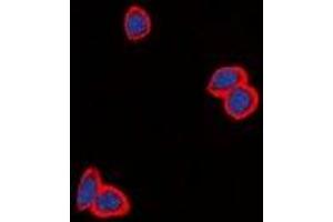 Immunofluorescent analysis of EGFR staining in MCF cells. (EGFR Antikörper  (C-Term))