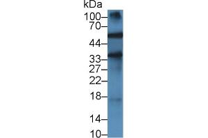 Detection of a1AGP in Rat Testis lysate using Monoclonal Antibody to Alpha-1-Acid Glycoprotein (a1AGP) (ORM1 Antikörper  (AA 19-186))