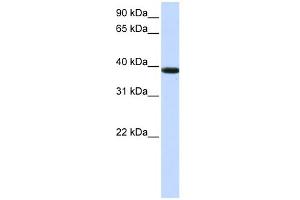 WB Suggested Anti-KLHDC8B Antibody Titration:  0. (KLHDC8B Antikörper  (Middle Region))