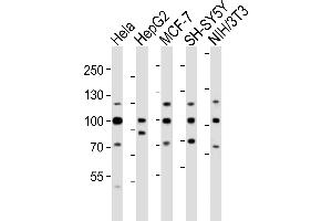 Western blot analysis of lysates from Hela, HepG2, MCF-7, SH-SY5Y, mouse NIH/3T3 cell line (from left to right), using FGFR1 Antibody (Center) (ABIN6243223 and ABIN6577702). (FGFR1 Antikörper  (AA 291-324))