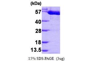 SDS-PAGE (SDS) image for Pyruvate Kinase M2 (PKM2) (AA 1-531) protein (His tag) (ABIN666913)
