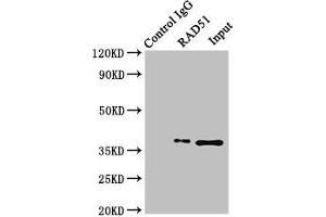 Immunoprecipitating RAD51 in K562 whole cell lysate Lane 1: Rabbit control IgG (1 μg) instead of ABIN7150287 in K562 whole cell lysate. (RAD51 Antikörper  (AA 1-228))