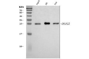 Western blot analysis of SNAP23 using anti-SNAP23 antibody (ABIN7599089). (SNAP23 Antikörper  (AA 1-211))