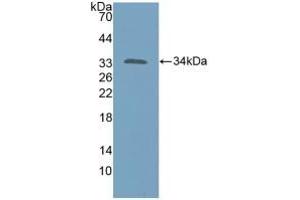 Detection of Recombinant KATNA1, Human using Polyclonal Antibody to Katanin P60 Subunit A 1 (KATNA1) (KATNA1 Antikörper  (AA 8-229))