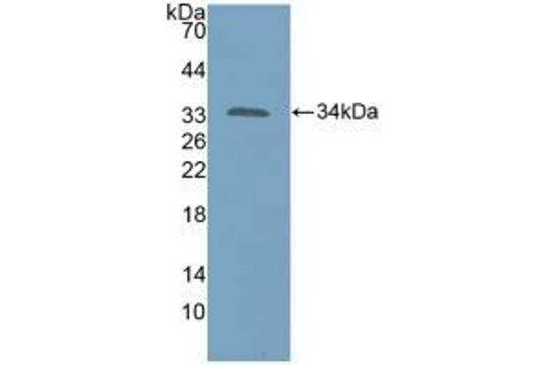 KATNA1 Antikörper  (AA 8-229)