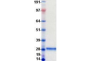 Western Blotting (WB) image for WAP Four-Disulfide Core Domain 1 (WFDC1) protein (DYKDDDDK-His Tag) (ABIN2735550)