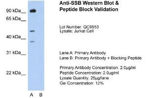 Host:  Rabbit  Target Name:  SSB  Sample Type:  Jurkat  Lane A:  Primary Antibody  Lane B:  Primary Antibody + Blocking Peptide  Primary Antibody Concentration:  2. (SSB Antikörper  (N-Term))