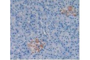 IHC-P analysis of Human Pancreas Tissue, with DAB staining. (Substance P Antikörper)