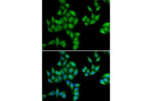 Immunofluorescence analysis of HeLa cells using BTG1 antibody (ABIN5973768). (BTG1 Antikörper)