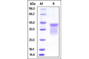 Human HVEM, His Tag on SDS-PAGE under reducing (R) condition. (HVEM Protein (AA 39-202) (His tag))