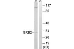 Western blot analysis of extracts from Jurkat cells, using GRB2 Antibody. (GRB2 Antikörper  (AA 141-190))