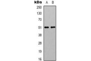 Western blot analysis of GABRA2 expression in mouse brain (A), rat brain (B) whole cell lysates.