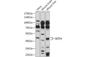 Western blot analysis of extracts of various cell lines, using SETD4 antibody (ABIN7270264) at 1:1000 dilution. (SETD4 Antikörper  (AA 210-300))