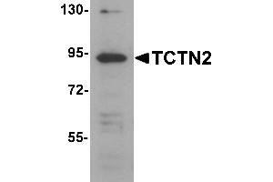 Western blot analysis of TCTN2 in SK-N-SH cell lysate with TCTN2 antibody at 1 µg/mL. (TCTN2 Antikörper  (C-Term))