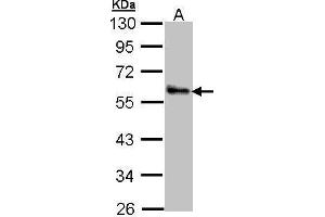 WB Image Sample (30 ug of whole cell lysate) A: A431 , 10% SDS PAGE antibody diluted at 1:1000 (ZNF259 Antikörper  (Center))