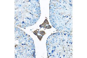 Immunohistochemistry of paraffin-embedded mouse testis using IDS Rabbit pAb (ABIN3015633, ABIN3015634, ABIN3015635 and ABIN6218988) at dilution of 1:200 (40x lens). (IDS Antikörper  (AA 34-290))