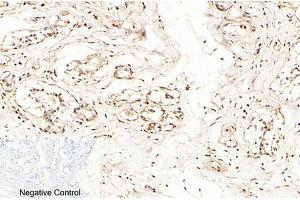 Immunohistochemical analysis of paraffin-embedded human breast tissue. (Caspase 7 Antikörper  (AA 160-240))