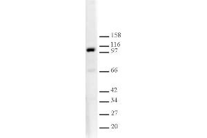 L3MBTL1 antibody tested by Western blot.