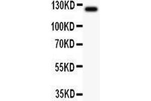 Anti-TIE2 Picoband antibody,  All lanes: Anti TIE2  at 0. (TEK Antikörper  (AA 641-830))